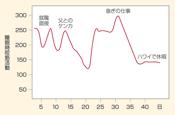 ダウンロード